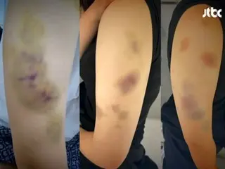 「她暈過去了我還繼續打她」…跆拳道教練未經允許闖入女高中生宿舍，對她進行無差別毆打（韓國）