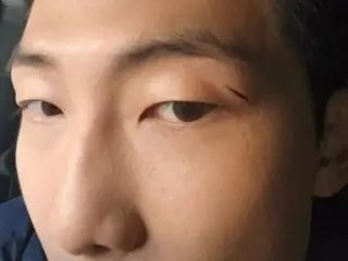 「BTS」RM英俊的臉上露出了深深的傷疤……眼睛上方有一道痛苦的傷疤