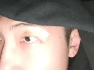 《BTS》RM，眼睛上方的傷疤還好嗎？